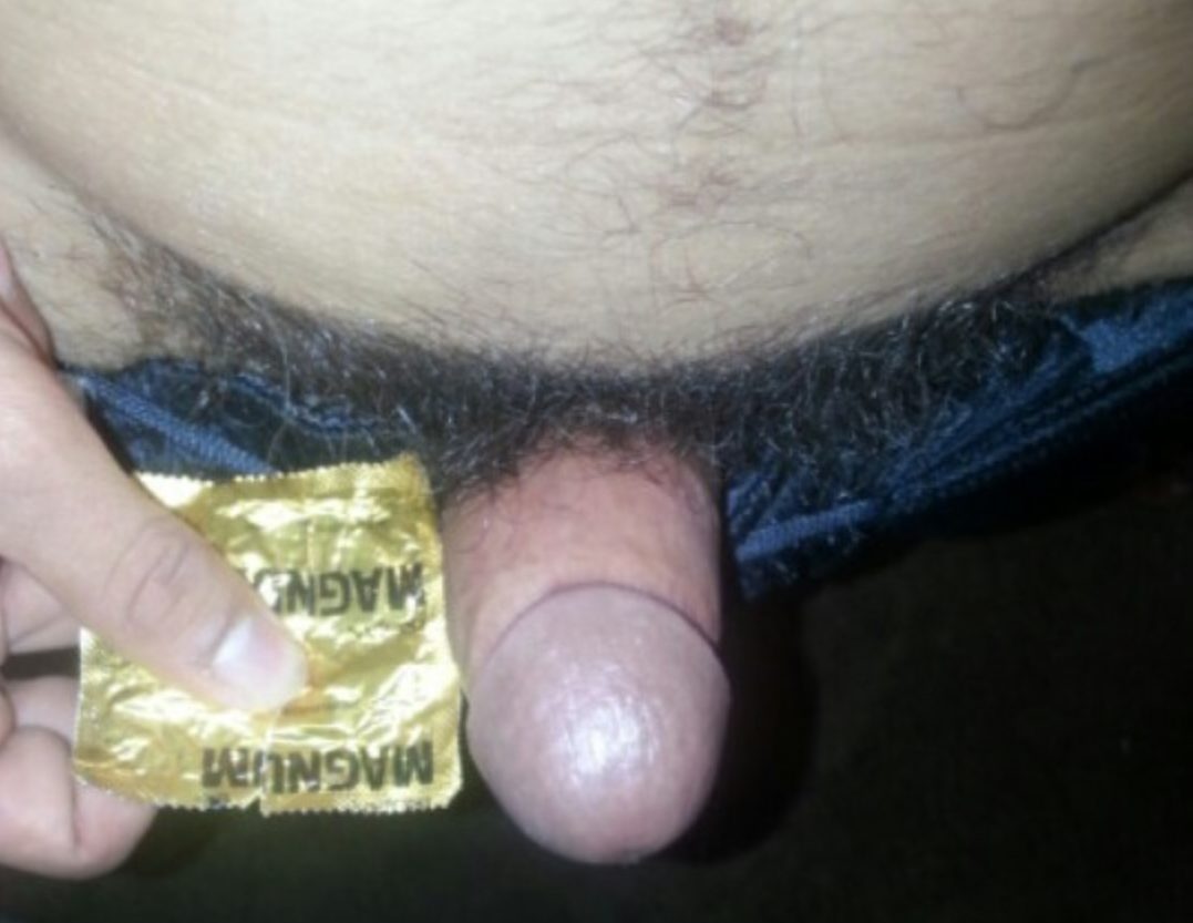 Micropenis compared to a magnum condom.