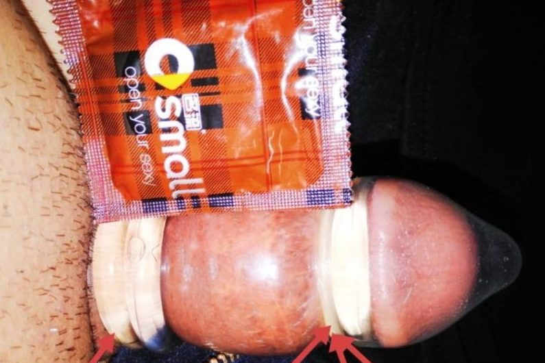 Tiny Dick 🍄 vs XXS Small Condom