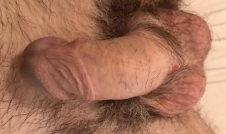 I have a small and ugly tiny penis