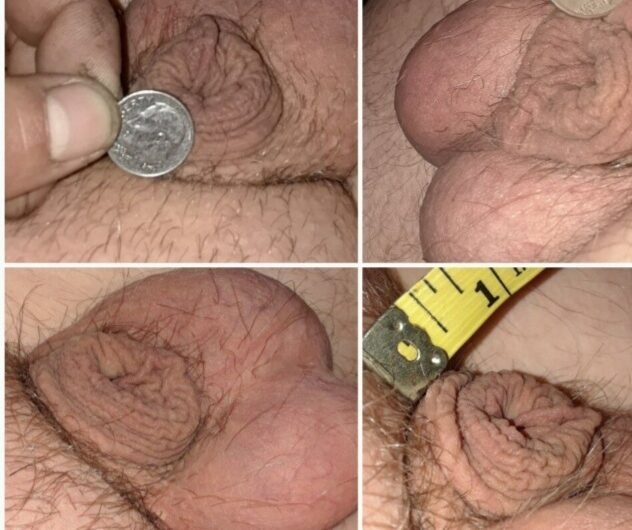 He is packing a half inch innie micropenis!