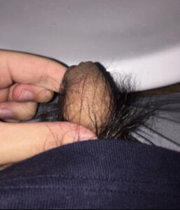 Small Asian Micropenis