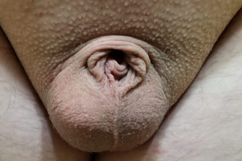 Dick so small it looks like a weird vagina with balls