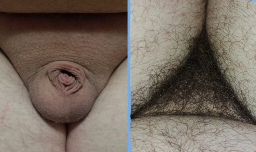 My Clitty is Smaller than William’s Dicklette