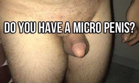 Textbook example of a micropenis.