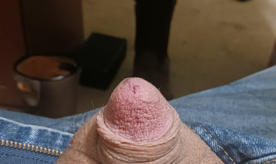 This penis is all head, no shaft
