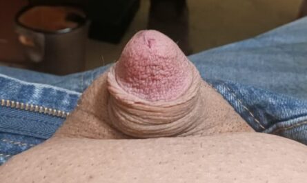This penis is all head