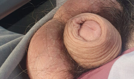 Girlfriend knows about my shriveled pecker but not this